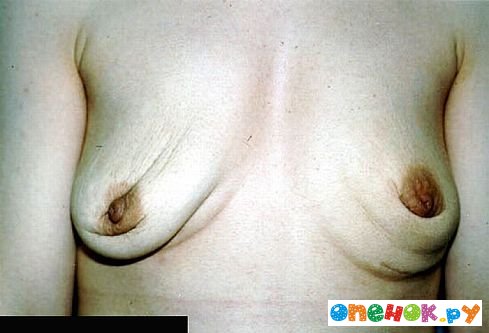 27 самых ужасных сисек!! (27 фото) 27 самых ужасных сисек!! (27 фото)